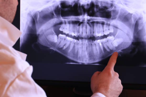 Best Pediatric Emergency Dentist in Mountain View, HI
